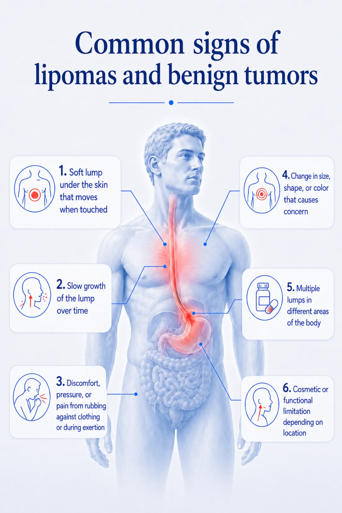 Common signs of lipomas and benign tumors