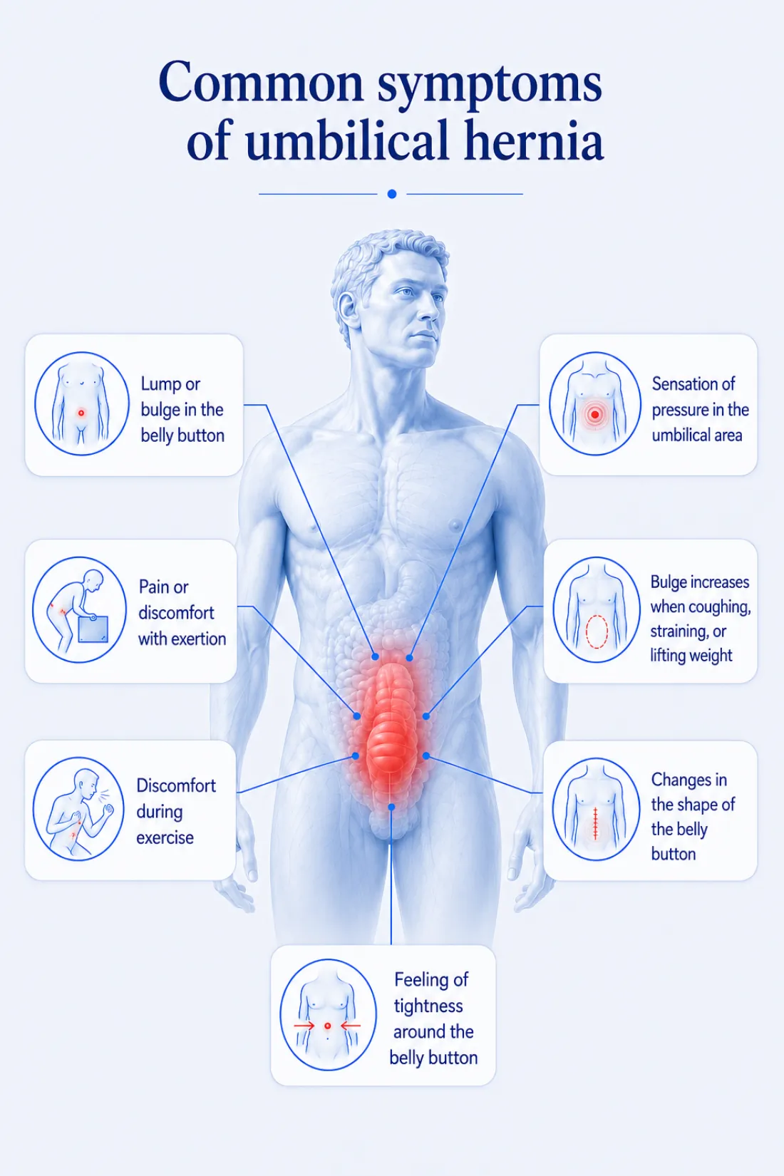 Signs of an umbilical hernia