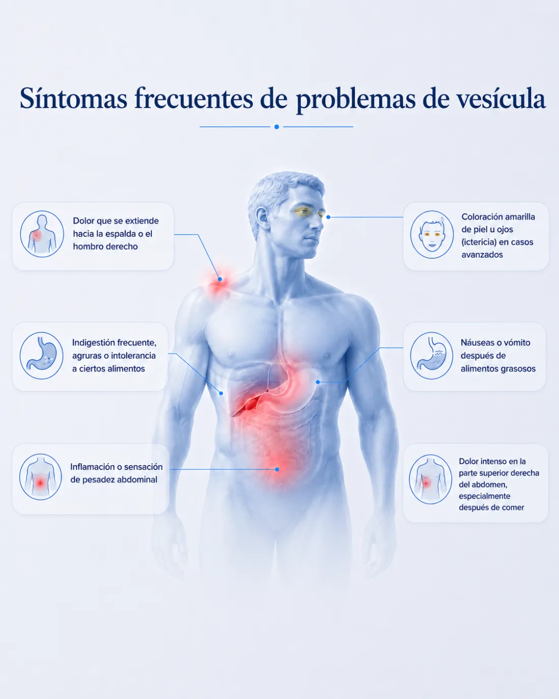 Síntomas frecuentes de piedras en la vesícula